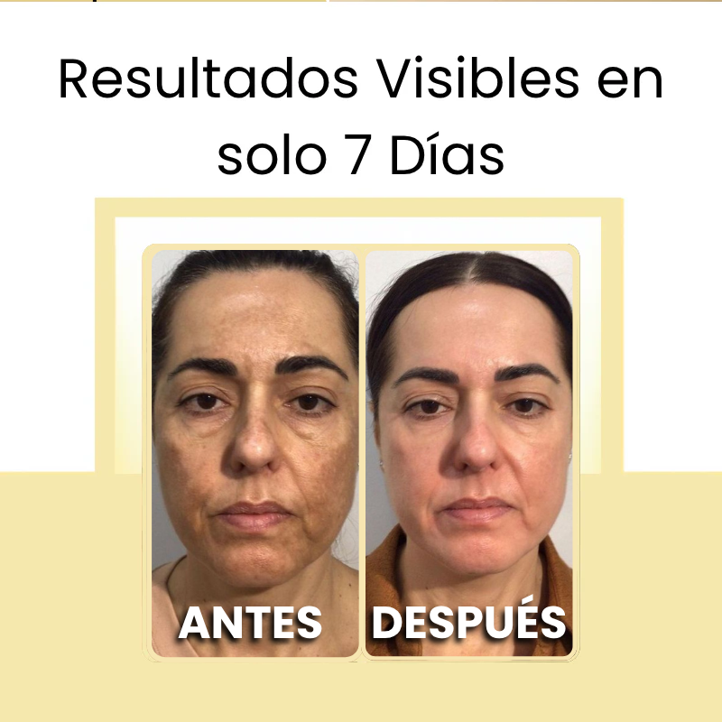 Kit Anti-Melasma Dermanix