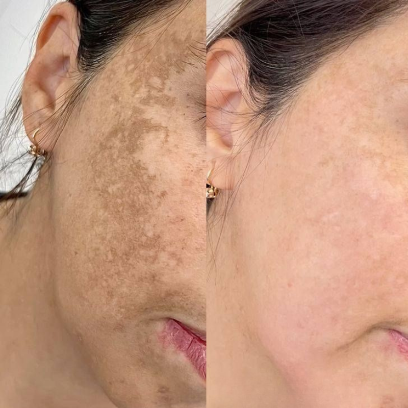 <p><strong>Descubre las historias de quienes ya usaron Dermanix</strong>® </p>