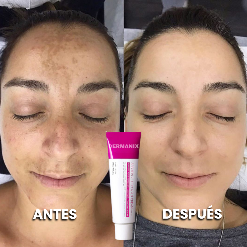 Elimina las manchas con Revive | Dermanix
