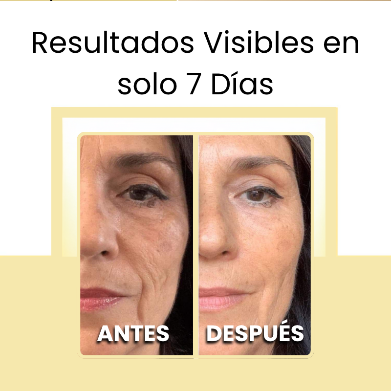 Kit Antiarrugas Dermanix | Tratamiento Coreano