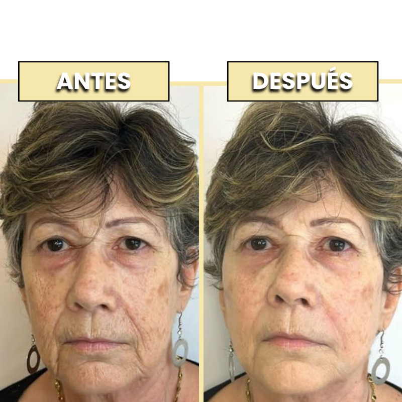 Kit Antiarrugas Dermanix | Tratamiento Coreano