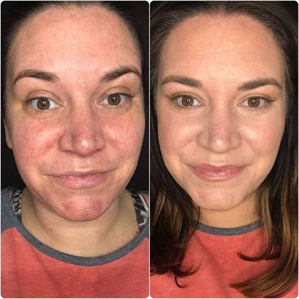 <p><strong>Descubre las historias de quienes ya usaron Dermanix</strong>® </p>